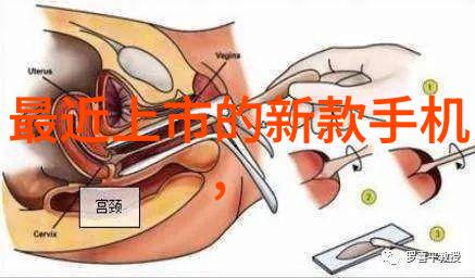 如果在安装过程中发现结构或材料问题该怎么处理才能保证最终效果的质量